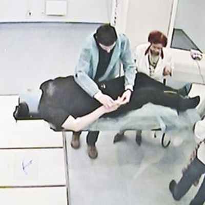 Укладка пациента перед лечением на КиберНоже