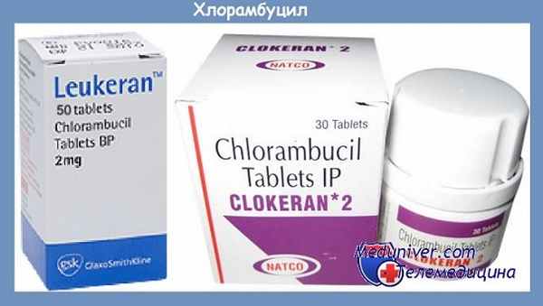 Хлорамбуцил для лечения хронического лимфолейкоза