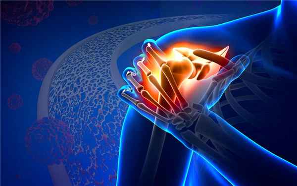 Хондросаркома