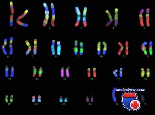 хромосомные аномалии в гематологии