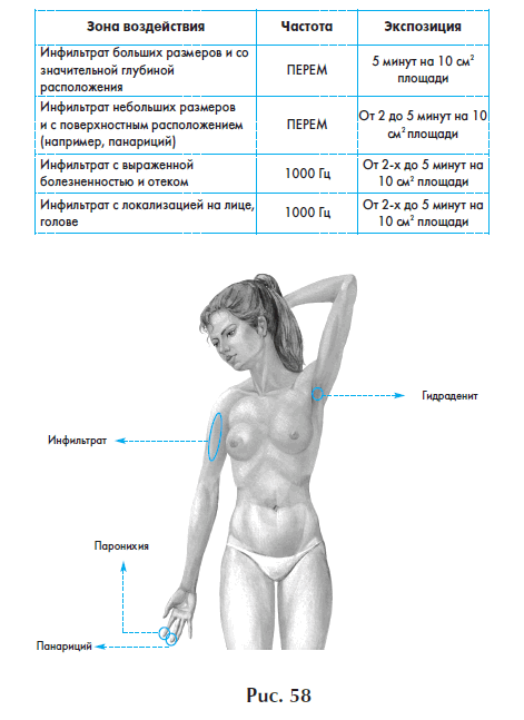 Лечение воспалительных заболеваний