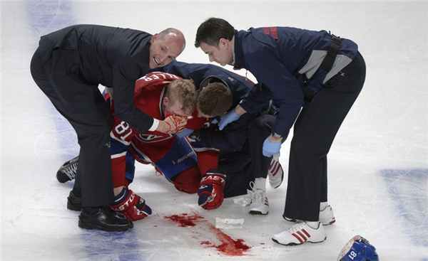 Серьёзные травмы в хоккее.