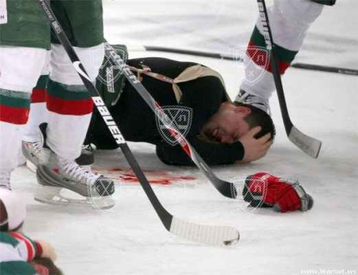 Удар головой в хоккее.