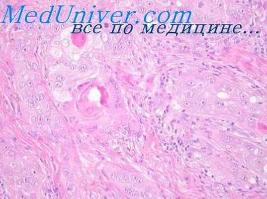 контактный дерматит