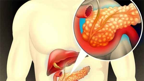 Поджелудочной железа