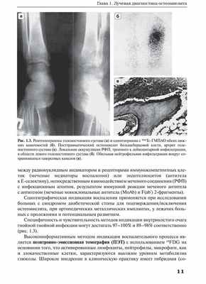 Рис. 1.3. Рентгенограммы голеностопного сустава