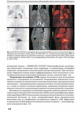 Рис. 1.4. ПЭТ. КТ. ПЭТ/КТ
