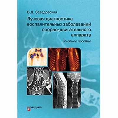 Лучевая диагностика воспалительных заболеваний опорно-двигательного аппарата - Завадовская В. Д.