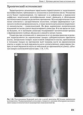 Рис. 1.16. Рентгенограммы бедренной кости