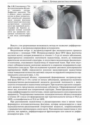 Рис. 1.10. Сцинтиграмма