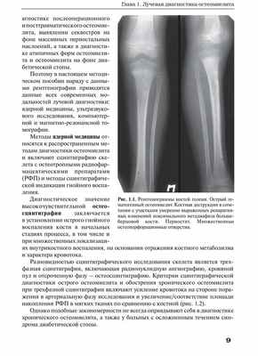 Рис. 1.1. Рентгенограммы костей голени.