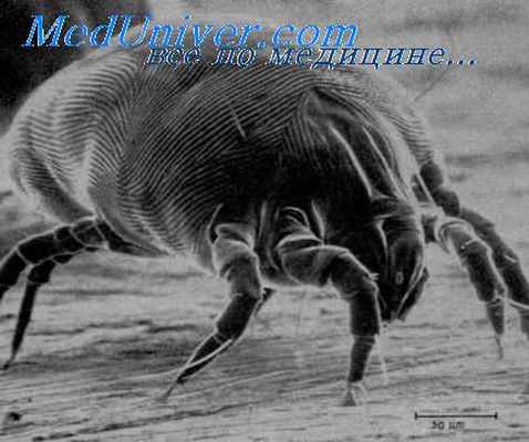 анемия хронических состояний