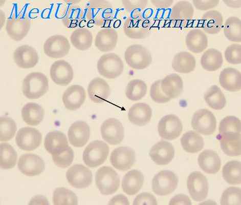 мышьяковистый водород