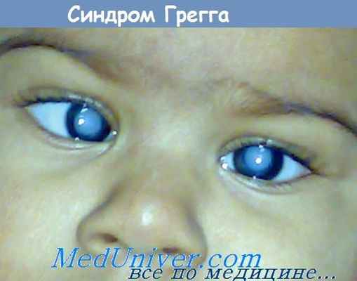 Саблевидная