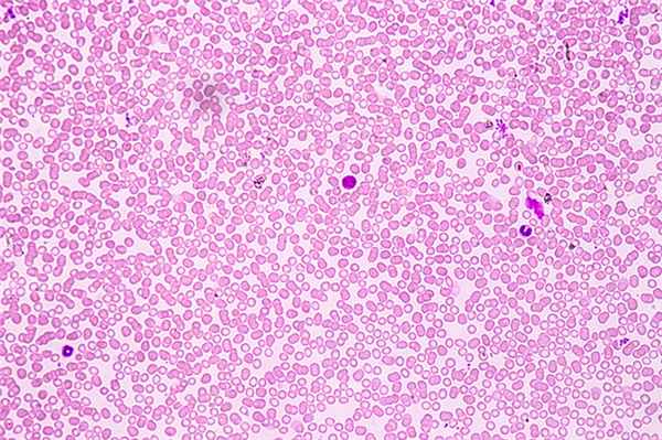 Моноциты в крови, фото