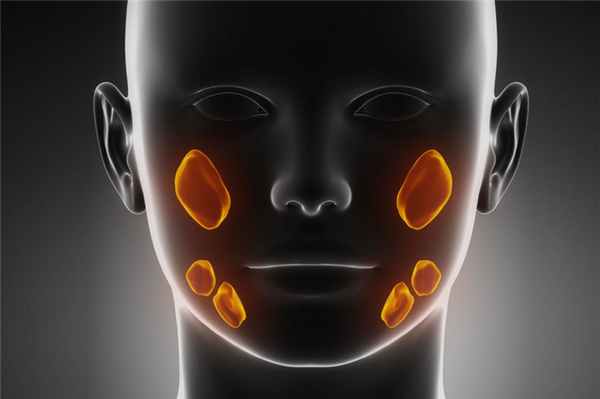 Сиалоаденит