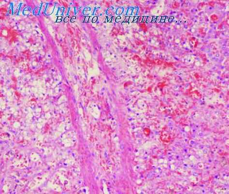 сосудистые анастомозы