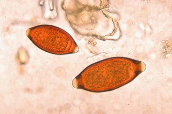 Яйца власоглава (Trichuris trichiura)