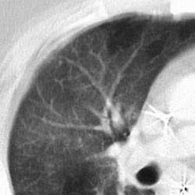 затемнение по типу матового стекла