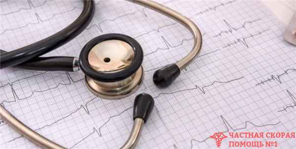 Экстрасистолия и алкоголь