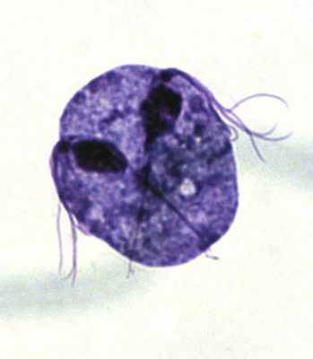 На этой фотографии жгутиконосец Trichomonas vaginalis изображен в процессе клеточного деления (он делится вдоль). Фото с сайта www.k-state.edu