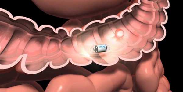рак-тонкого-кишечника