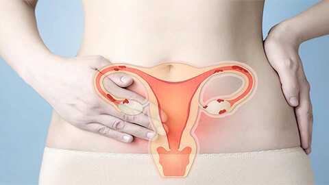 Сальпингоофорит