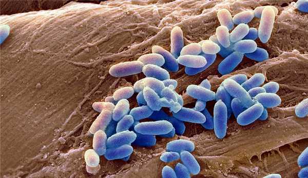 Синегнойная палочка