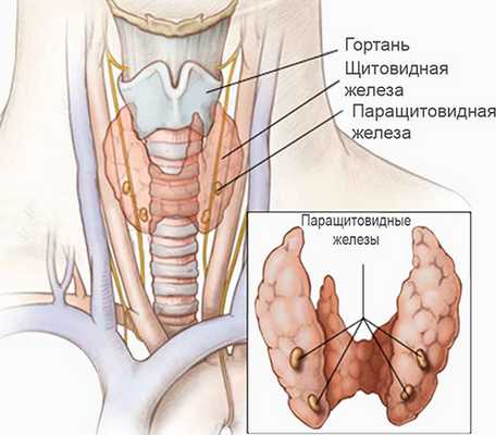 Синдром Ди Джорджи