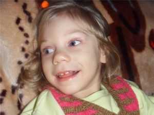 девочка с нарушением развития