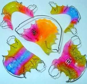 В зависимости от типа нарушения окклюзии подбирают индивидуальные устройства.