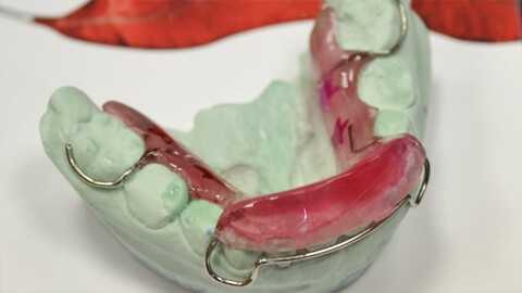 каппа шварца