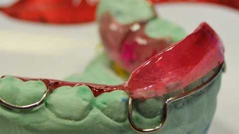 каппа шварца