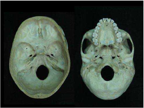 3D-реконструкция с помощью компьютерной томографии