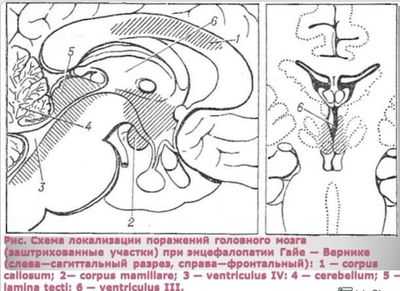 нарушения функций мозга