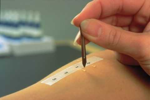 Проводятся специальные кожные пробы