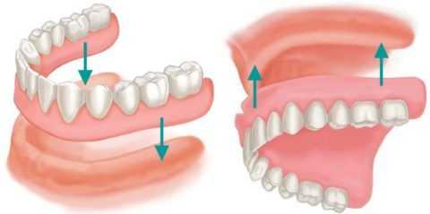 Зубные протезы должны быть прочными