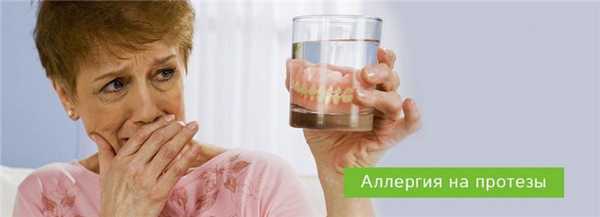 Аллергия на зубные протезы - симптомы и лечение