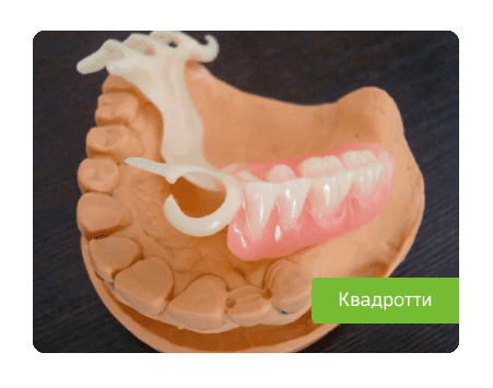 протез Квадротти фото