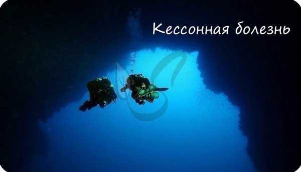 Кессонная болезнь