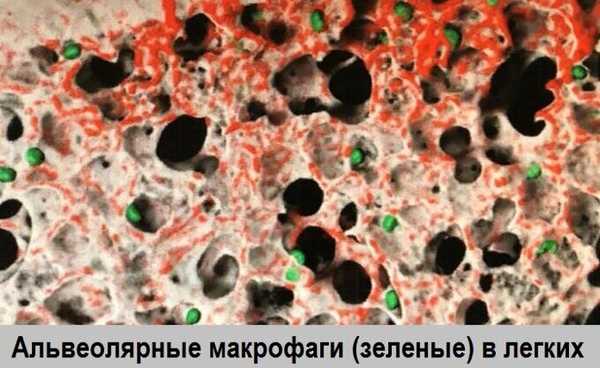 alveolyarnye_makrofagi_v_legkih.jpg