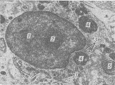 Рис. 2. Электронограмма части макрофага в очаге асептического воспаления: 1 — ядро; 2 — ядрышко; 3 — Эндоплазматический ретикулум; 4 — фагосомы; 5 — остаточные тельца; 6 — митохондрии.