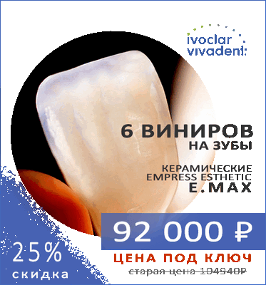 Акция 6 виниров на зубы