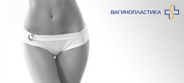 фото вагинопластика
