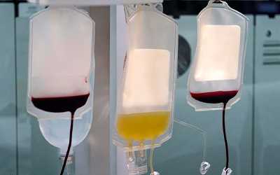 Плазмаферез - Салерно 