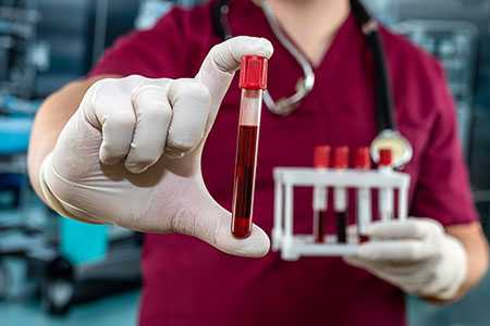 Как проверяют на наркотики в крови - Клиника ЛОРДМЕД