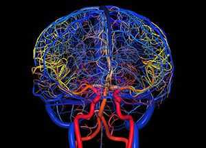 Сосуды головного мозга