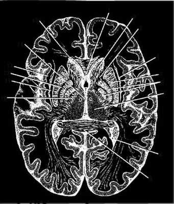 Горизонтальный разрез головного мозга