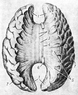 Рис. Макропрепарат головного мозга человека (вид сверху), часть вещества полушарий удалена; слева удален пояс, открыты мозолистое тело и лучистость мозолистого тела: 1 — лучистость мозолистого тела; 2 — медиальная продольная полоска; 3 — ствол мозолистого тела; 4 — латеральная продольная полоска; 5 — дугообразные волокна извилин головного мозга; 6 — пояс (частично удален); 7 — полушария извилин головного мозга.