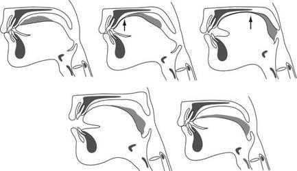 An external file that holds a picture, illustration, etc. Object name is nihms-79127-f0004.jpg